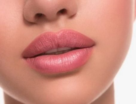 RussianLips opvulling