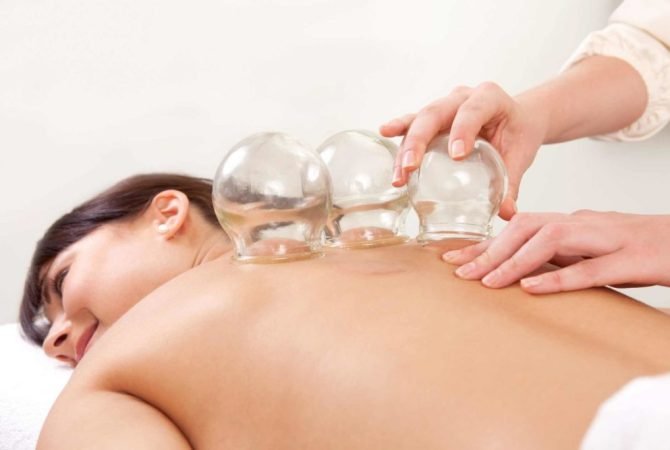 cupping massage
