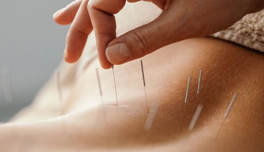 Alternatieve therapieën