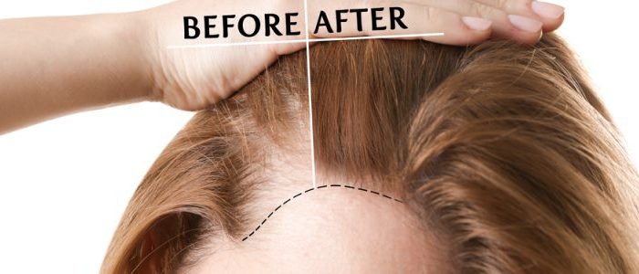 Haarbooster behandeling Amsterdam