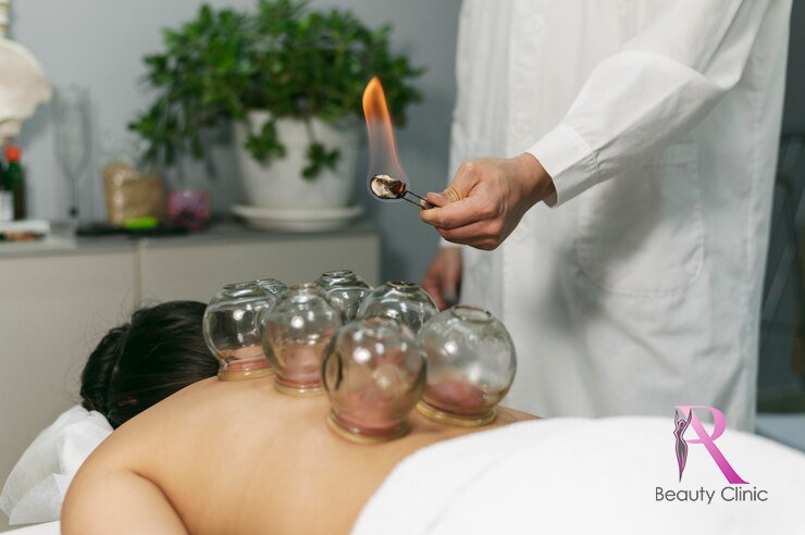 Cupping Warme massage
