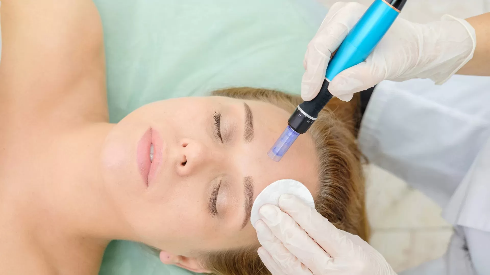 MicroNeedling: Collageen Inductie Therapie