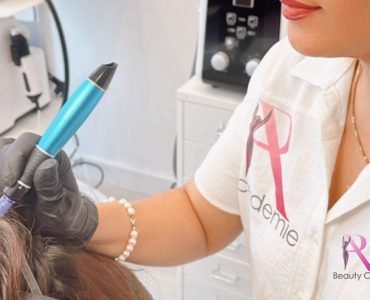 Mesotherapie voor Haar Amsterdam