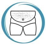 Microneedling fat crack