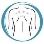 Licham Microneedling + BIORePeelCI3