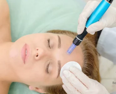 Voordelen van Microneedling