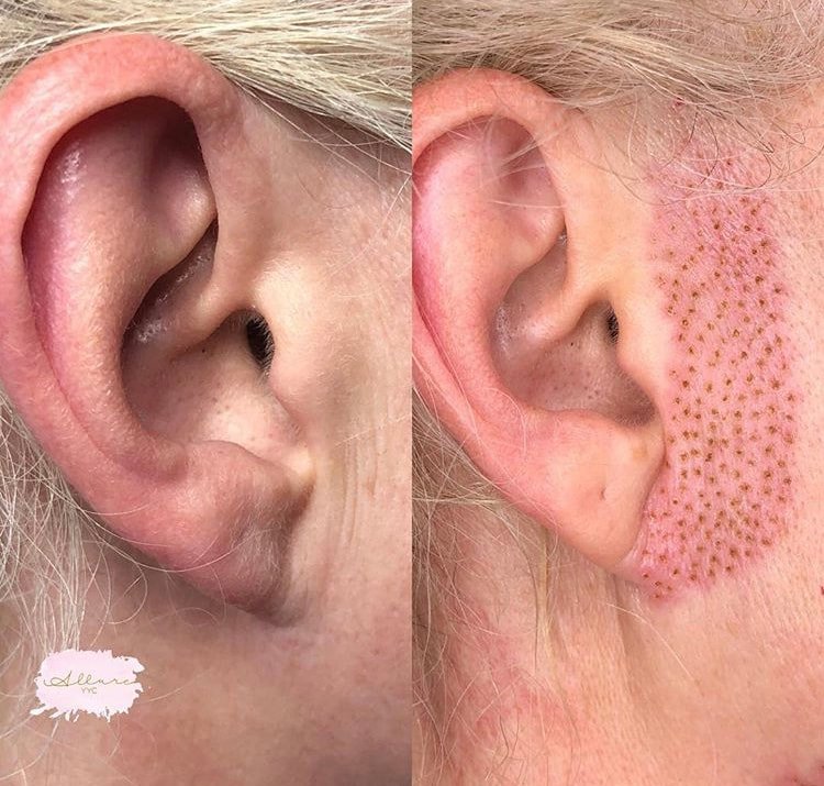 Plasma Oorplooien Amsterdam