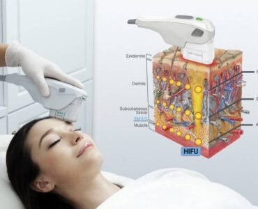 HIFU-therapie