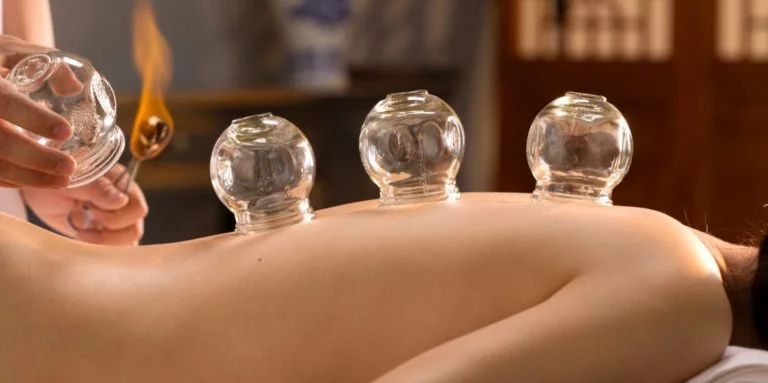 warme cuppingmassage