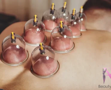 Alles wat je moet weten over cuppingtherapie